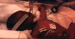 Preemie
